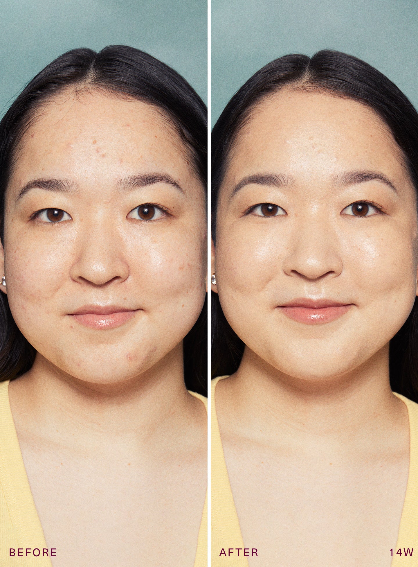 positive light tinted moisturizer broad spectrum spf 20 sunscreen positive light tinted moisturizer broad spectrum spf 20 sunscreen